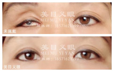 110013772.jpg 4ff087fe83474cc3ad2e342564b993be.jpg