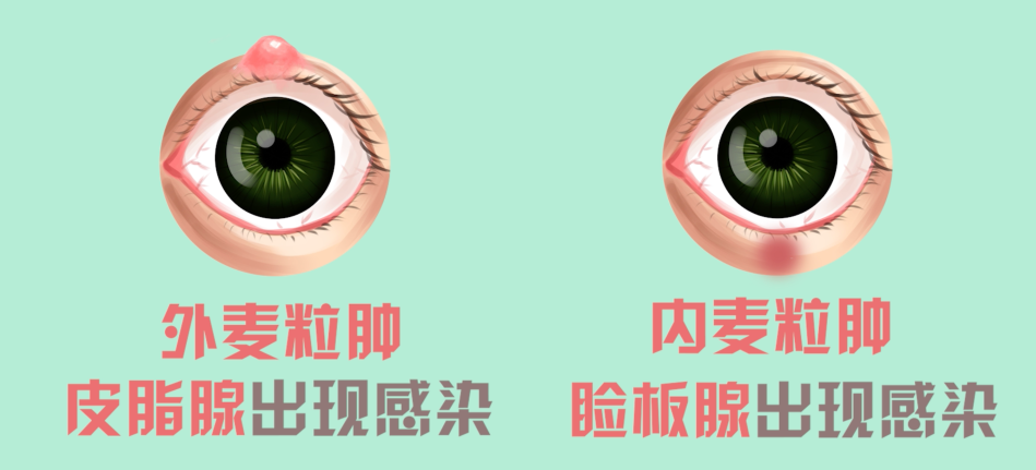 麦1.png